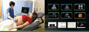 Instrumen Ultrasound Medis Hitam dan Putih, Perangkat Pemindai Ultrasound Genggam Portabel dengan <span class=keywords><strong>Probe</strong></span> untuk Dokter Hewan atau Manusia - Product Image 6