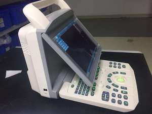 Nieuwe model Draagbare Ultrasound machine, MSLPU46 promotie prijs goedkope echografie, Zwangerschap test - Product Image 2