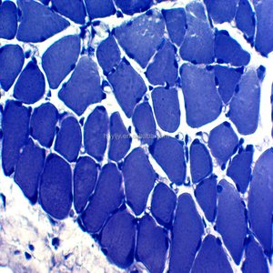 Skelettmuskulatur T. S. und L histologie rutschen/Menschlichen histologie rutschen menschlichen geweben rutschen - Product Image 2