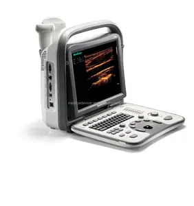 Sonoscape A6 portatile color doppler ad ultrasuoni con certificato Internazionale