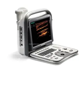 Sonoscope A6 portable couleur, doppler avec certificat internationale