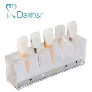 โมเดลการรักษารากฟันด้วยยางเรซินแบบใหม่ขั้นตอนการตัดรากฟันกลาง<span class=keywords><strong>5</strong></span>ขั้นตอน - Product Image 4