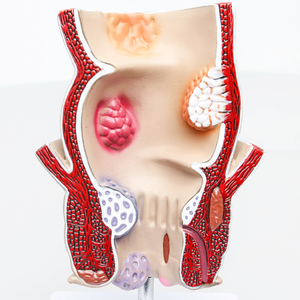 Gelsonlab HSBM-297 пластиковая модель высокого качества для прямой и анальной перегородки - Product Image 4