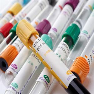 Médicos desechables PET <span class=keywords><strong>BD</strong></span> <span class=keywords><strong>Vacutainer</strong></span> sangre al vacío tubo de ensayo - Product Image 3