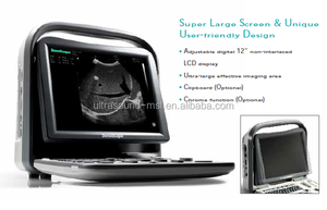 <span class=keywords><strong>Sonoscape</strong></span> <span class=keywords><strong>A5V</strong></span> B/W Portable Veterinary <span class=keywords><strong>Ultrasound</strong></span> Mesin - Product Image 2