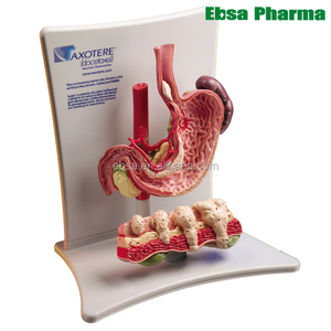 Avanzada suministros médicos enseñanza humana cáncer <span class=keywords><strong>de</strong></span> estómago modelo - Product Image 1