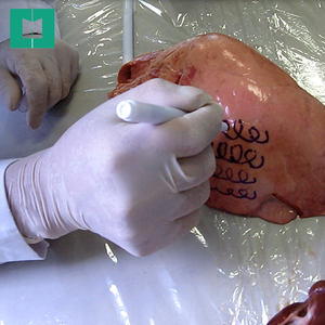 Medical sterile surgical pen water base ink Skin Medical Marker pen - Product Image 3