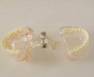 Dentale denti Trasparente modello <span class=keywords><strong>Standard</strong></span> - Product Image 4