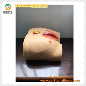BIX-H10 Ciencia Médica úlcera de decúbito cuidados de enfermería maniquí - Product Image 2
