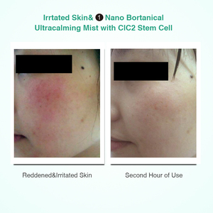 Ensemble de soins de la peau en spray Nano Zinc Sliver, marque privée - Product Image 4