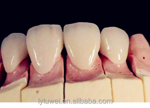 Migliore qualità <span class=keywords><strong>dental</strong></span> <span class=keywords><strong>lab</strong></span> ceram premere dentale forno - Product Image 3