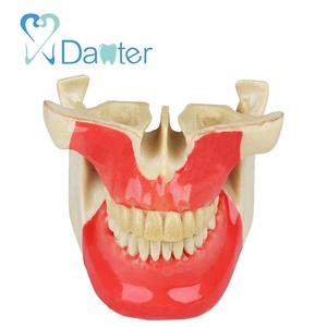 Hoge Kwaliteit Ortho Implantaat Praktijk Model Hars Materiaal - Product Image 2