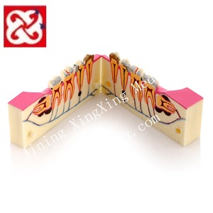Modèle médical endodontique, 5 cellules, pour les carpes, traitement des gencives - Product Image 1