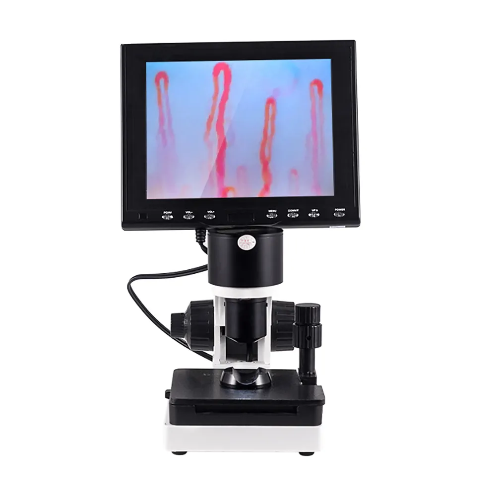 Biological Microscope Medical Blood Detecting Body Health Microcirculation Microscope Connected to Laptop