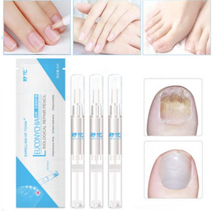 LOOKNICE - Pluma de Tratamiento para Onicomicosis y Paroniquia de Uñas, a Base de Hierbas Chinas, 3 ml, para Infecciones Fúngicas de Uñas - Product Image 5