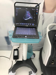 Sonoscape S9 High-End Tangan <span class=keywords><strong>Doppler</strong></span> Berwarna Terjemahan Mindray M7 Mesin Ultrasound - Product Image 4