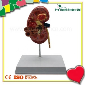 Modelo de Anatomía de riñón de enfermedad educativa médica de humano - Product Image 2