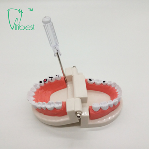 Vente directe d'usine : Modèle dentaire pathologique, <span class=keywords><strong>dents</strong></span> d'adulte pour l'enseignement médical - Product Image 6