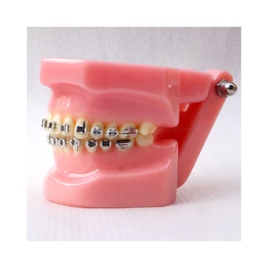 Modello dentale Ortodontico Con staffe in metallo - Product Image 2