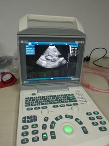 Hình Ảnh Tuyệt Vời Máy Siêu Âm Di Động, MSLPU46 Hotsell Giá Rẻ Siêu Âm, Mang Thai Kiểm Tra - Product Image 4