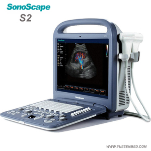 Ecógrafo Veterinario Doppler Color <span class=keywords><strong>4D</strong></span> Sonoscape S2V, Equipo de Ultrasonido Veterinario, Escáner de Ultrasonido Portátil Veterinario - Product Image 3