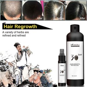 Balding สำหรับป้องกันผมร่วงและ30วันเร่ง Regrow เจริญเติบโตของเส้นผมโลชั่น - Product Image 4