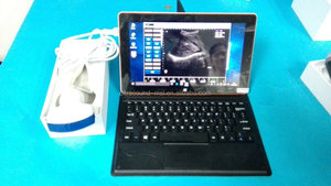 ラップトップ/超音波スキャンプローブ用MSLPU39超音波Usbプローブ - Product Image 6