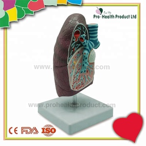 Modèle de poumon malade du système respiratoire en pathologie - Product Image 2