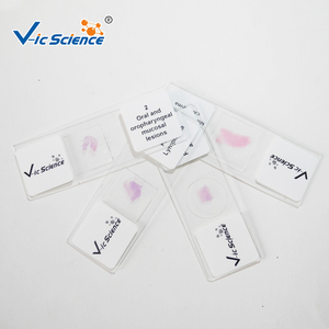 Lames préparées au microscope 48 pièces lames de pathologie buccale préparées au microscope pour l'enseignement de la pathologie en sciences médicales - Product Image 4