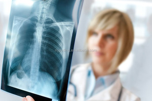 <span class=keywords><strong>Film</strong></span> radiographique médical bleu laser pour imprimante laser <span class=keywords><strong>Fuji</strong></span> Xerox - Product Image 2