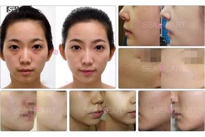 Popolare intermittente/continuo due modalità di funzionamento mesogun iniezione pistola ad acqua macchina di terapia - Product Image 6
