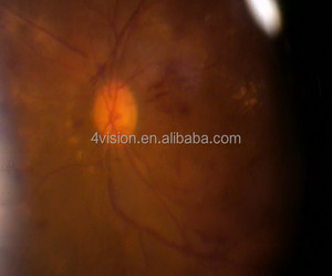 <span class=keywords><strong>Fundus</strong></span> görüntüleme görüntüleyici sistemi masaüstü yarık lamba - Product Image 4