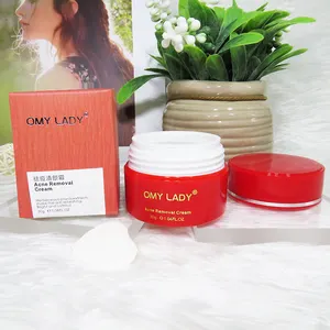 Omy Lady Herbal Beauty Hautcreme für Akne-Narben entfernen Oem/Private Label/kostenlose Probe
