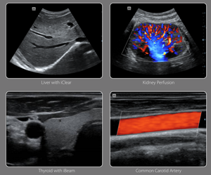 <span class=keywords><strong>Mindray</strong></span> Siêu Âm <span class=keywords><strong>DC</strong></span>-30 Xe Đẩy Loại Màu Doppler Máy Siêu Âm Với CE Và ISO - Product Image 5