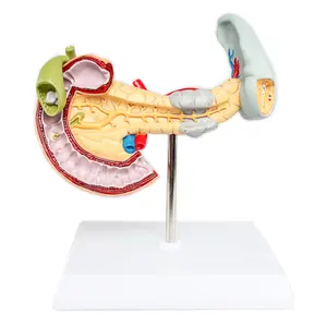 Gelsonlab HSBM-277 Laesies in de alvleesklier milt model De alvleesklier twaalfvingerige darm pathologie model