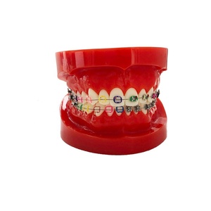 Roth ทันตกรรมจัดฟันวงเล็บ Ortodoncia รั้งตนเอง Ligating ยึด - Product Image 5