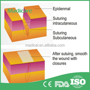 Adesivo Pelle Rinforzato chiusura della <span class=keywords><strong>ferita</strong></span> strisce, <span class=keywords><strong>Ferita</strong></span> della pelle chiusure - Product Image 5