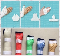 폴리머 열가소성 시트 정형 외과 골절 부목 - Product Image 3