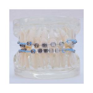Dentale Ortodontico modello Con staffa di ceramica - Product Image 4