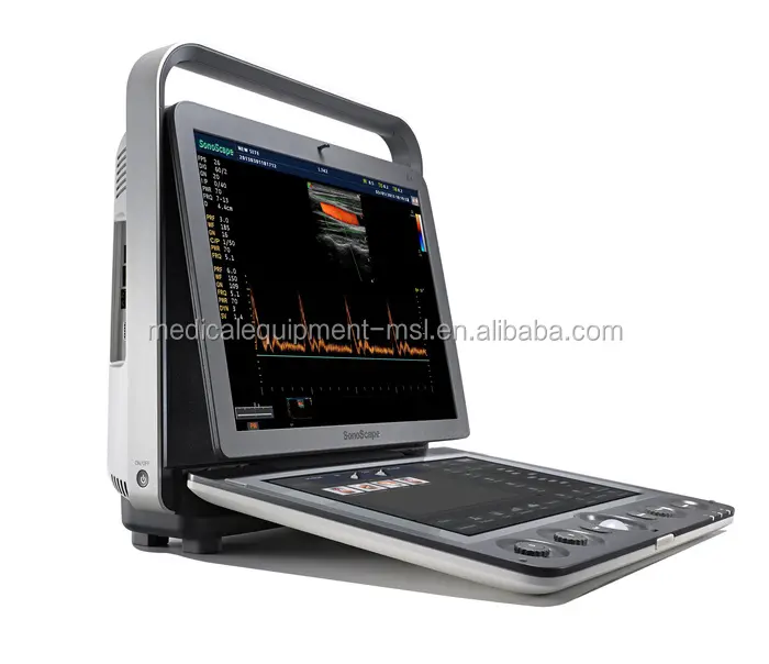 Sonoscope S9 Portable de système de Doppler couleur, ultrasonique avec logiciel d'imagerie de contraste