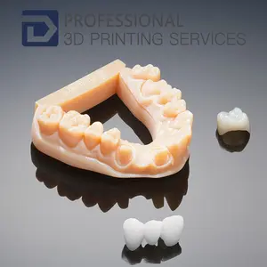 Zahn volle farbe Dental Aligners Chirurgische Guide 3d zahn modell