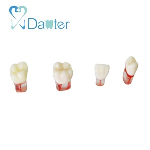 2025 הנמכר ביותר של שרף שיניים מודל עבור endodontic בפועל של אנדו שיניים חיוני כלי תעלת אנדו שורש מדע רפואי - Product Image 4