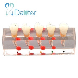 Hoogwaardige Hars Endodontische Behandelingsmodel Voor Het Demonstreren Van <span class=keywords><strong>5</strong></span> Stadia Van Wortelkanaalprocedure Op Tweede Premolaar - Product Image 3
