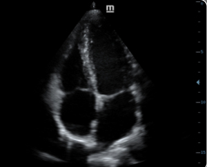 Máy siêu âm Doppler màu <span class=keywords><strong>4D</strong></span> Mindray Mindray Dc-30 - Product Image 6