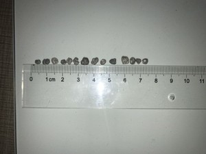 Fertilizzante DCP, MCP, MDCP, Fertilizzante a base di fosfato di calcio - Product Image 3