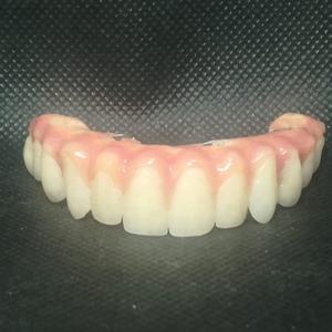 <span class=keywords><strong>PEEK</strong></span> peletler diş protez - Product Image 5