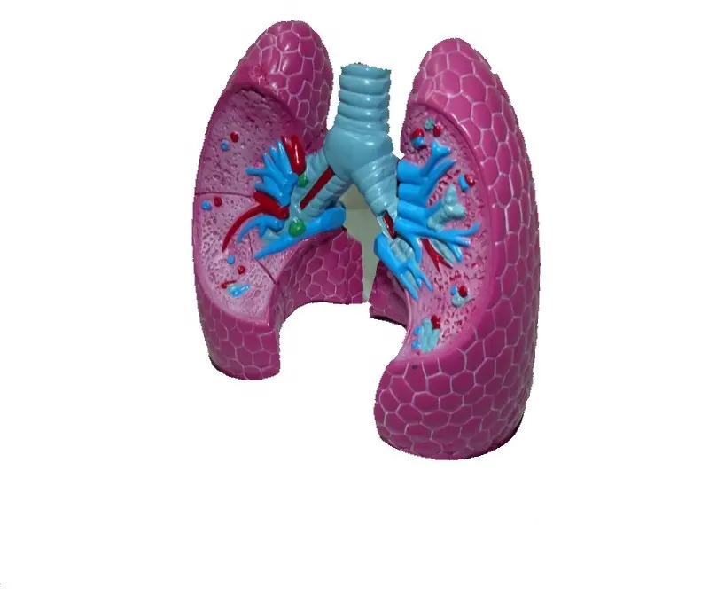 Kích thước đầy đủ mô hình của các bị bệnh phổi, Phổi bệnh lý mô hình giải phẫu