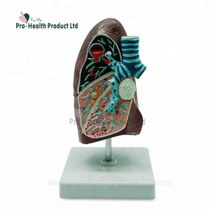 Modèle de poumon malade du système respiratoire en pathologie - Product Image 1