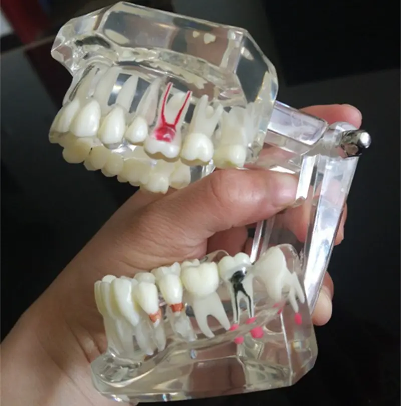 Hot sale Dental education models teeth and dental models