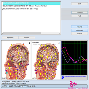 Latest 9d NLS analyzer health equipment physiotherapy disease analysis - Product Image 3